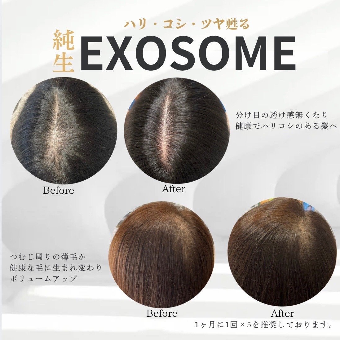 純正エキソソーム　ビフォーアフター