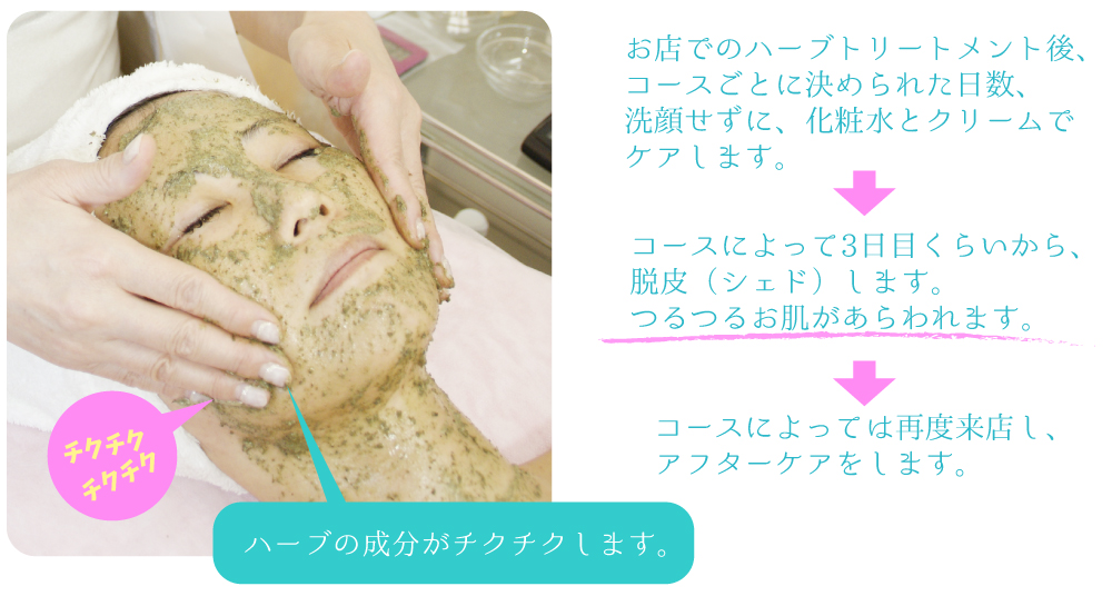 グリーンピールについて